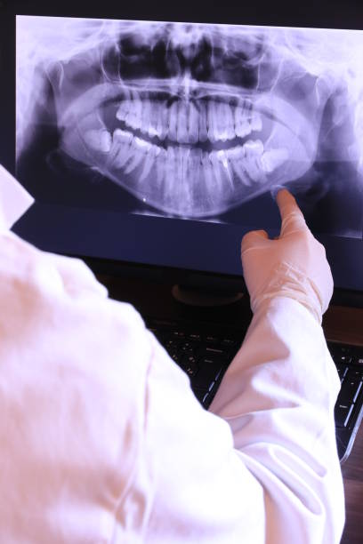 Best Emergency Treatment for Dental Infections or Abscesses in Gordon Heights, NY